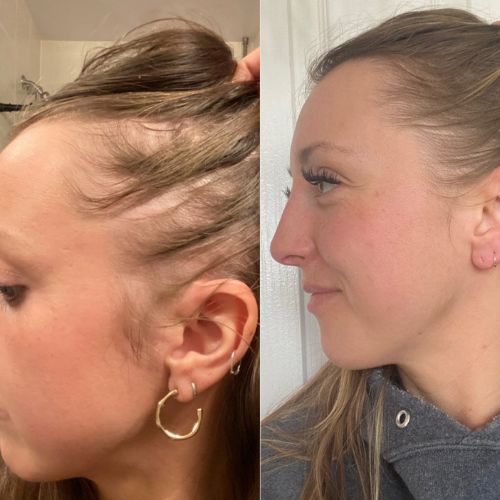 Before and After Using Repair Hair Oil For Thin Hair