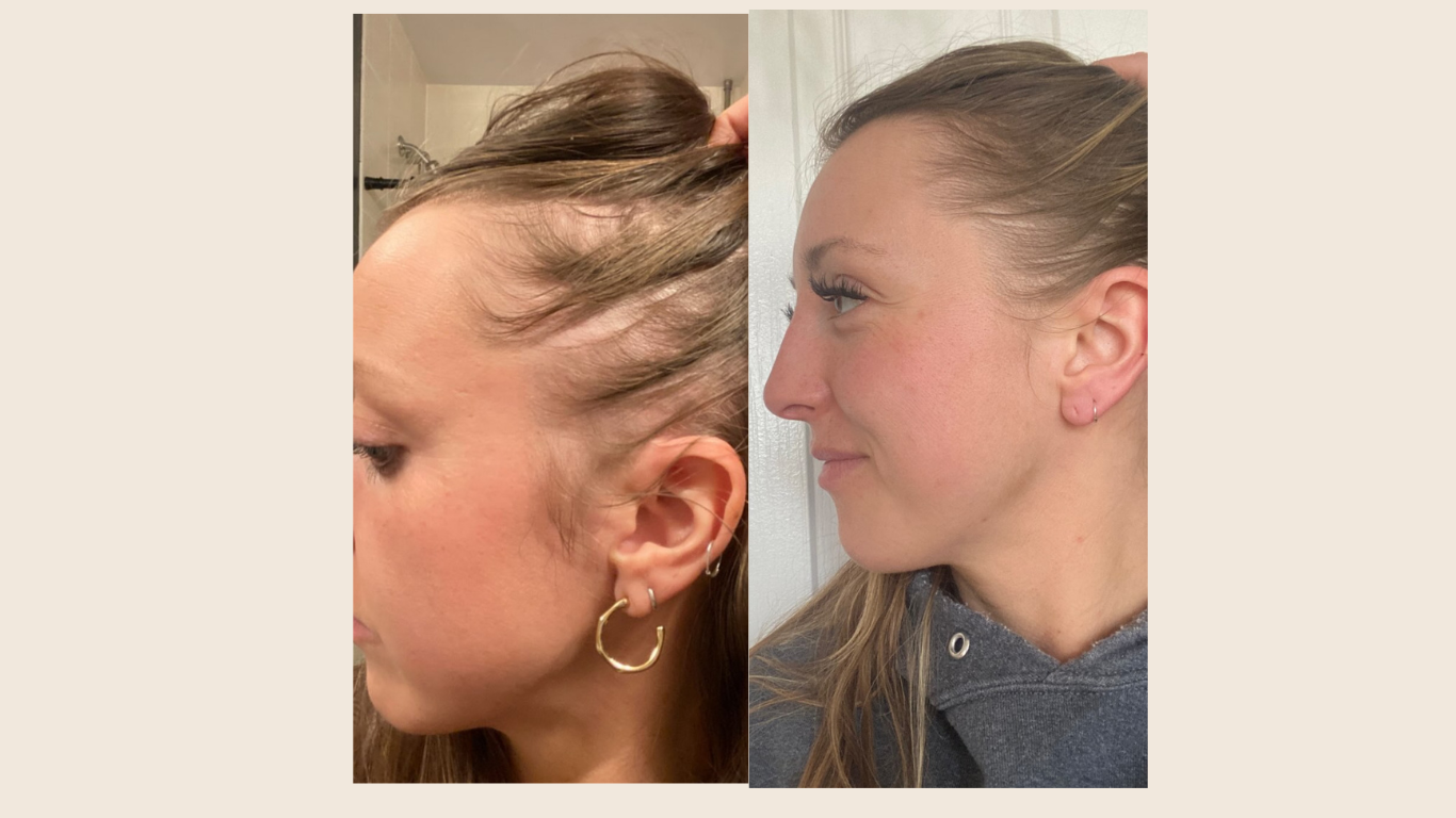 Repair Hair Oil Regrowth Before and After Photo