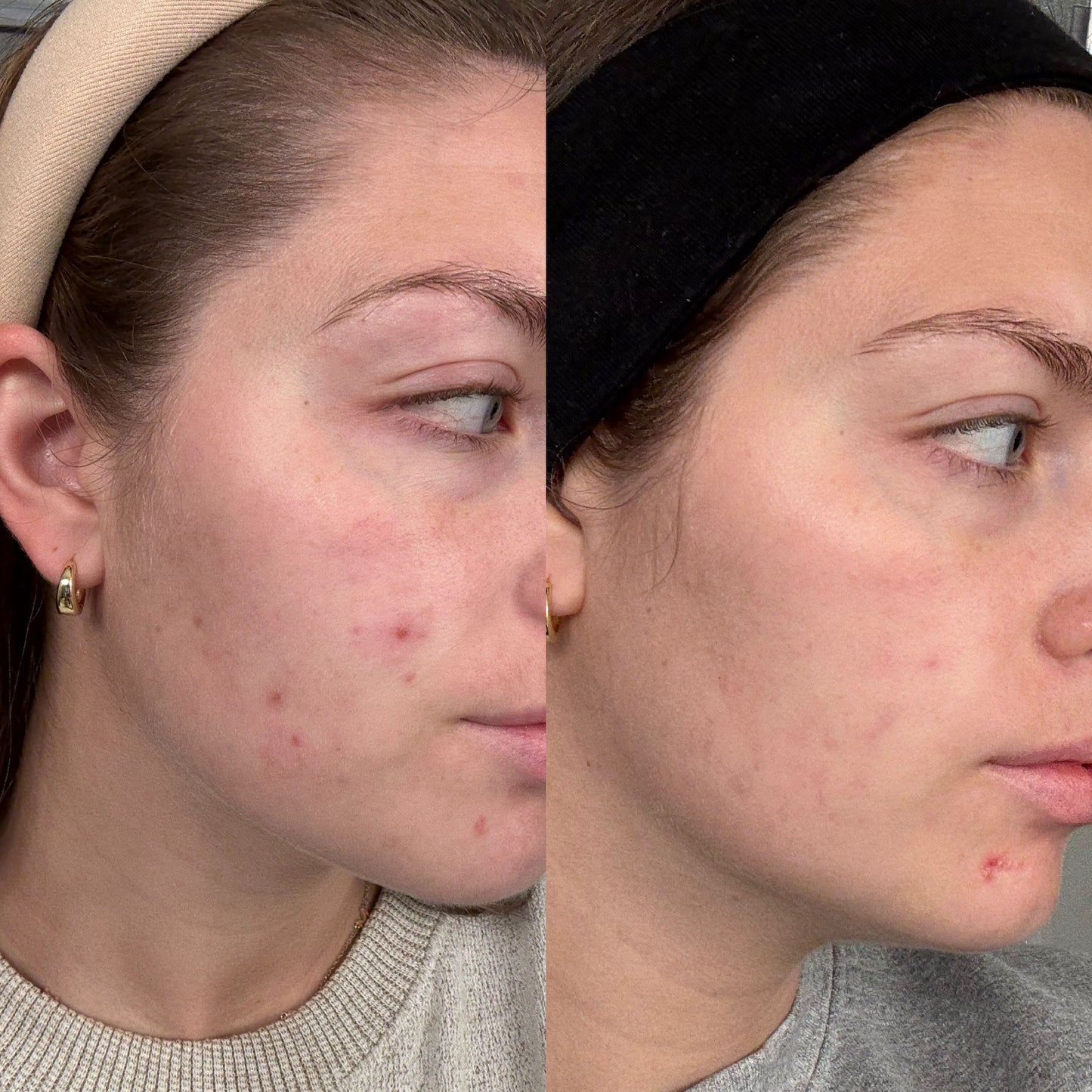 Evatasha Beauty Before & After