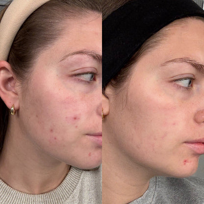 Evatasha Beauty Before & After