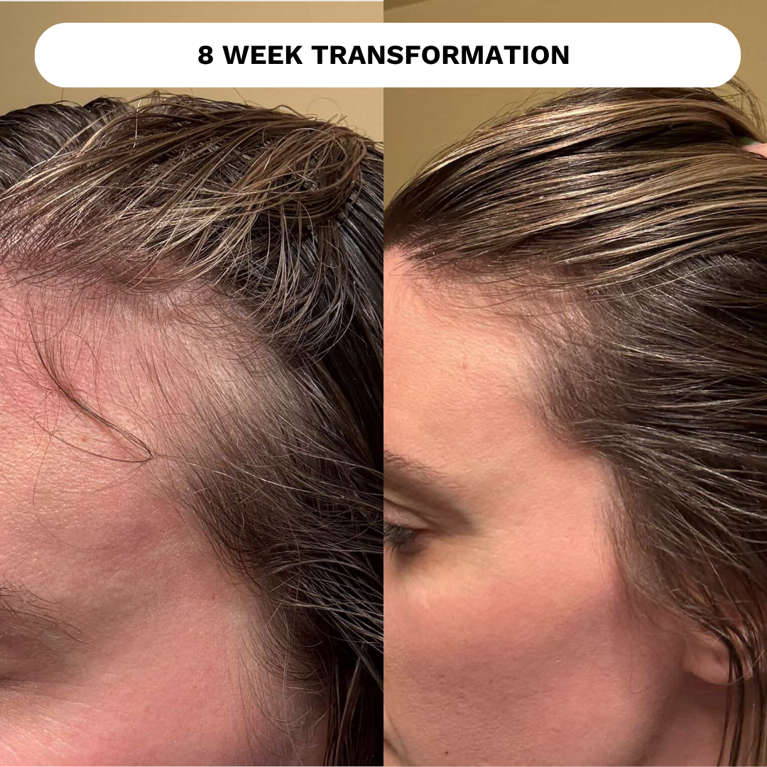 Restore Hair Recovery Tonic