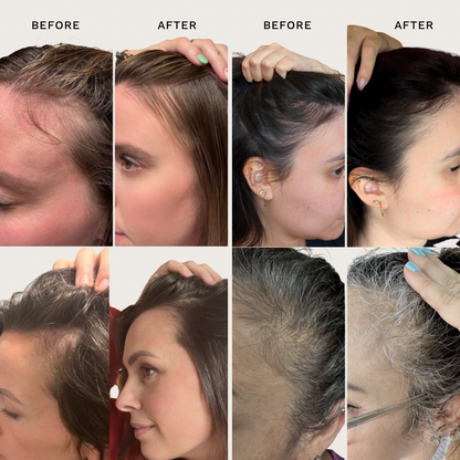 The Scalp Reset Trio