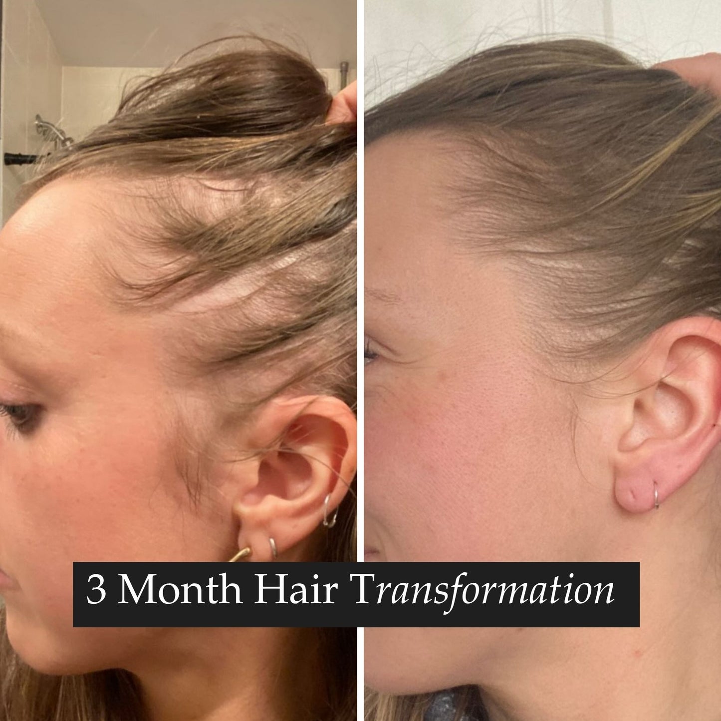 Evatasha Beauty Before and after comparison of a 3-month hair transformation.