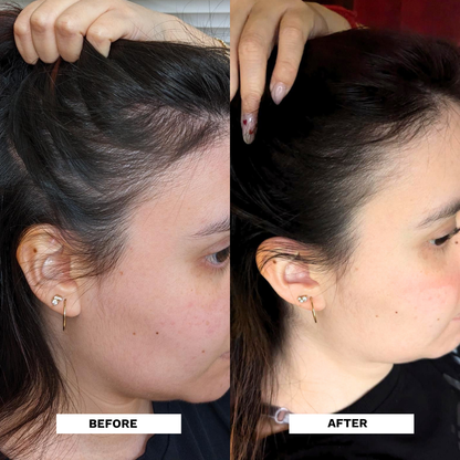 Restore Hair Recovery Tonic