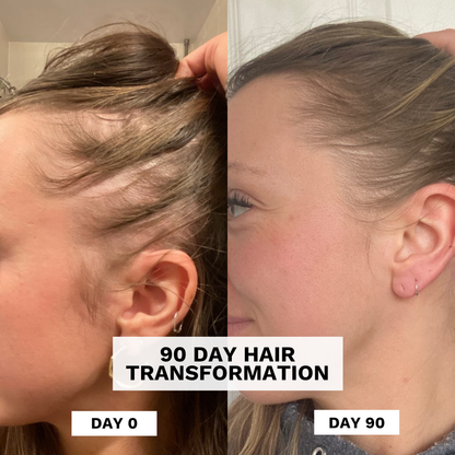 Evatasha Beauty 90 Day Hair Transformation comparison of a person's hair on Day 0 and Day 90.