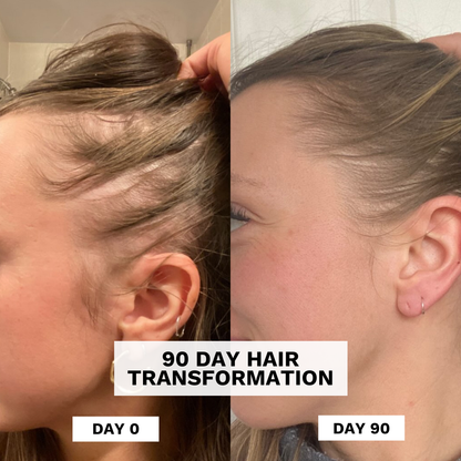 Repair Hair Growth Oil & Scalp Treatment