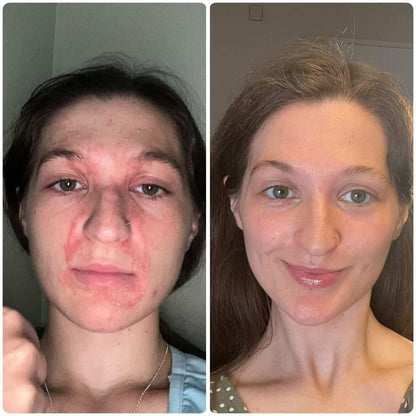 Evatasha Beauty Before & After