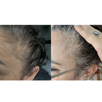 Repair Hair Oil & Scalp Treatment