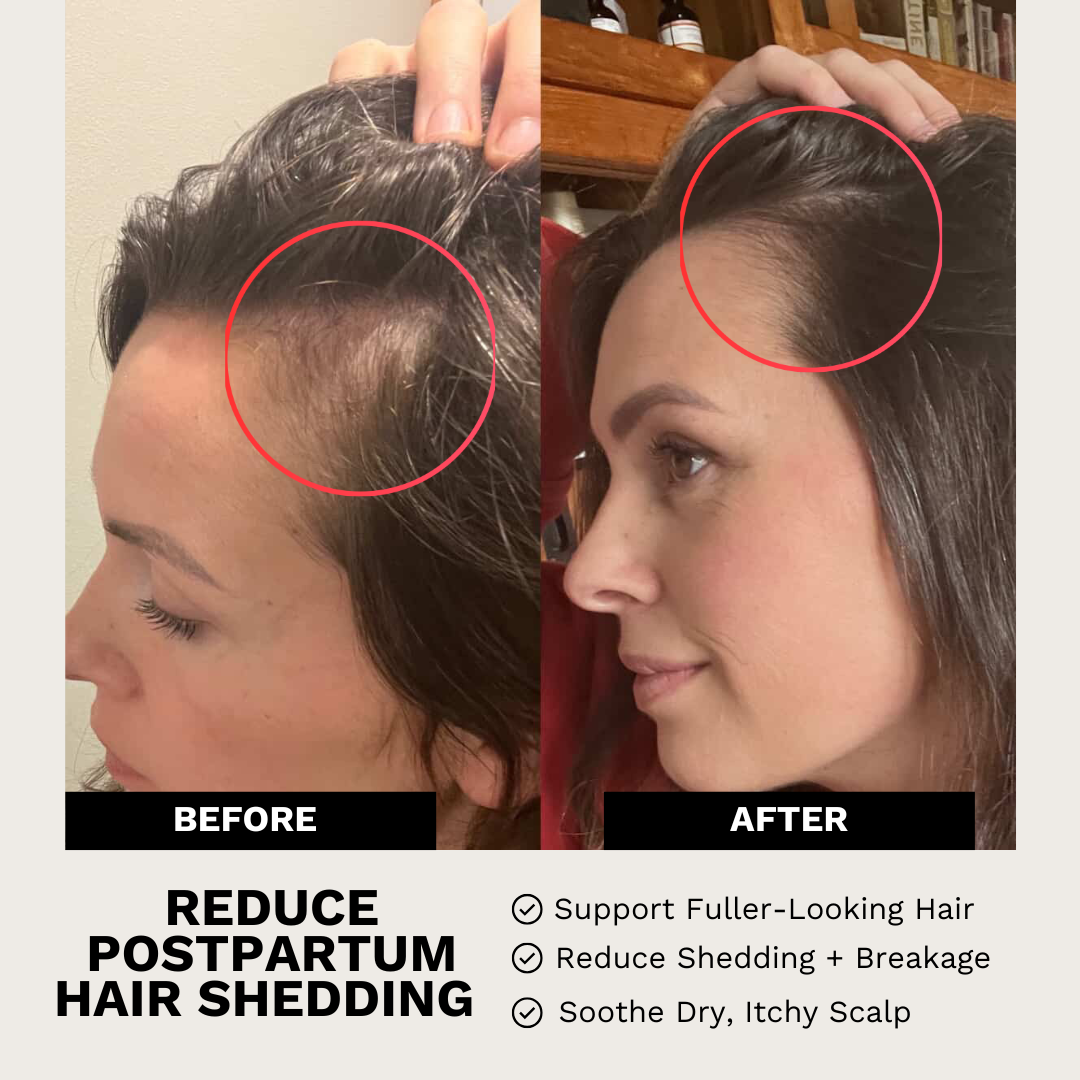 Restore Hair Recovery Tonic